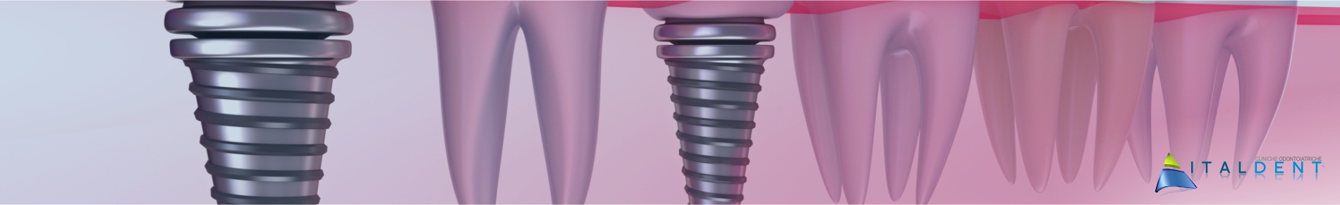 Clinica Odontoiatrica Italdent, Chirurgia Orale