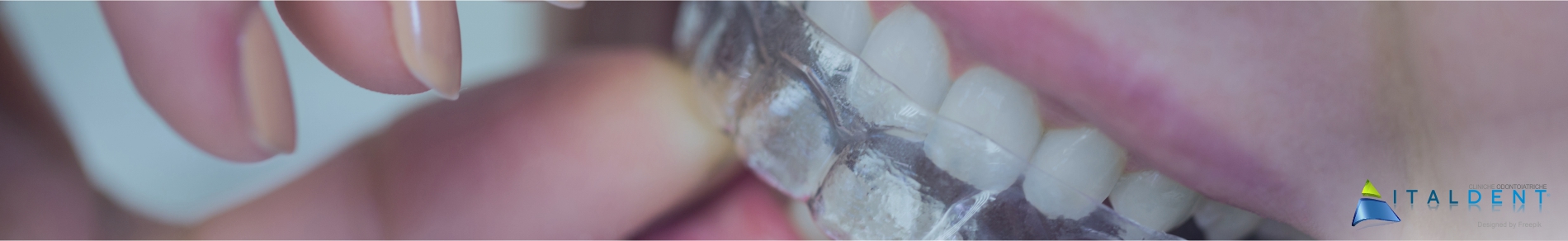 Clinica Odontoiatrica Italdent, Impianti post-estrattivi