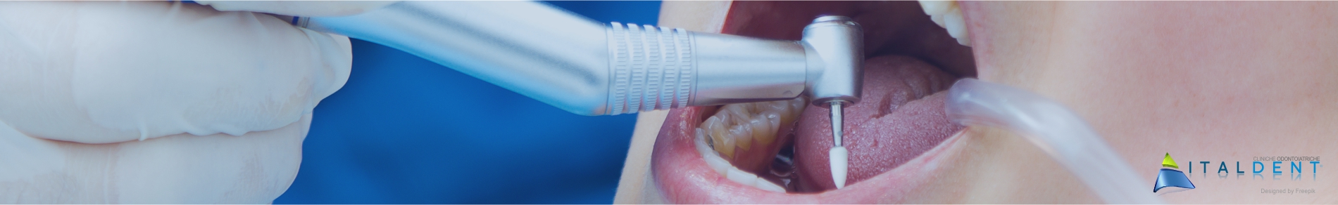 Clinica Odontoiatrica Italdent, Specialisti in chirugia implantare ed estetica del sorriso.