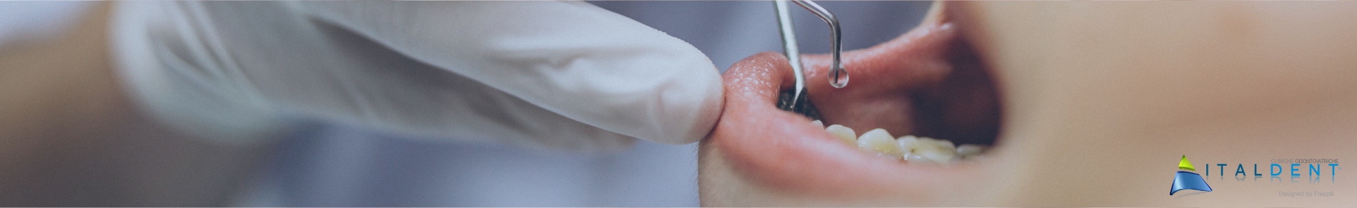 Clinica Odontoiatrica Italdent, Protesi dentale mobile