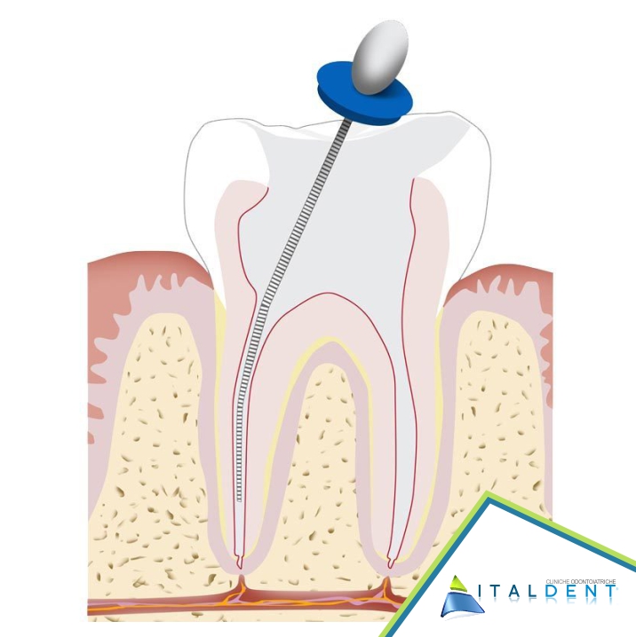 Endodonzia