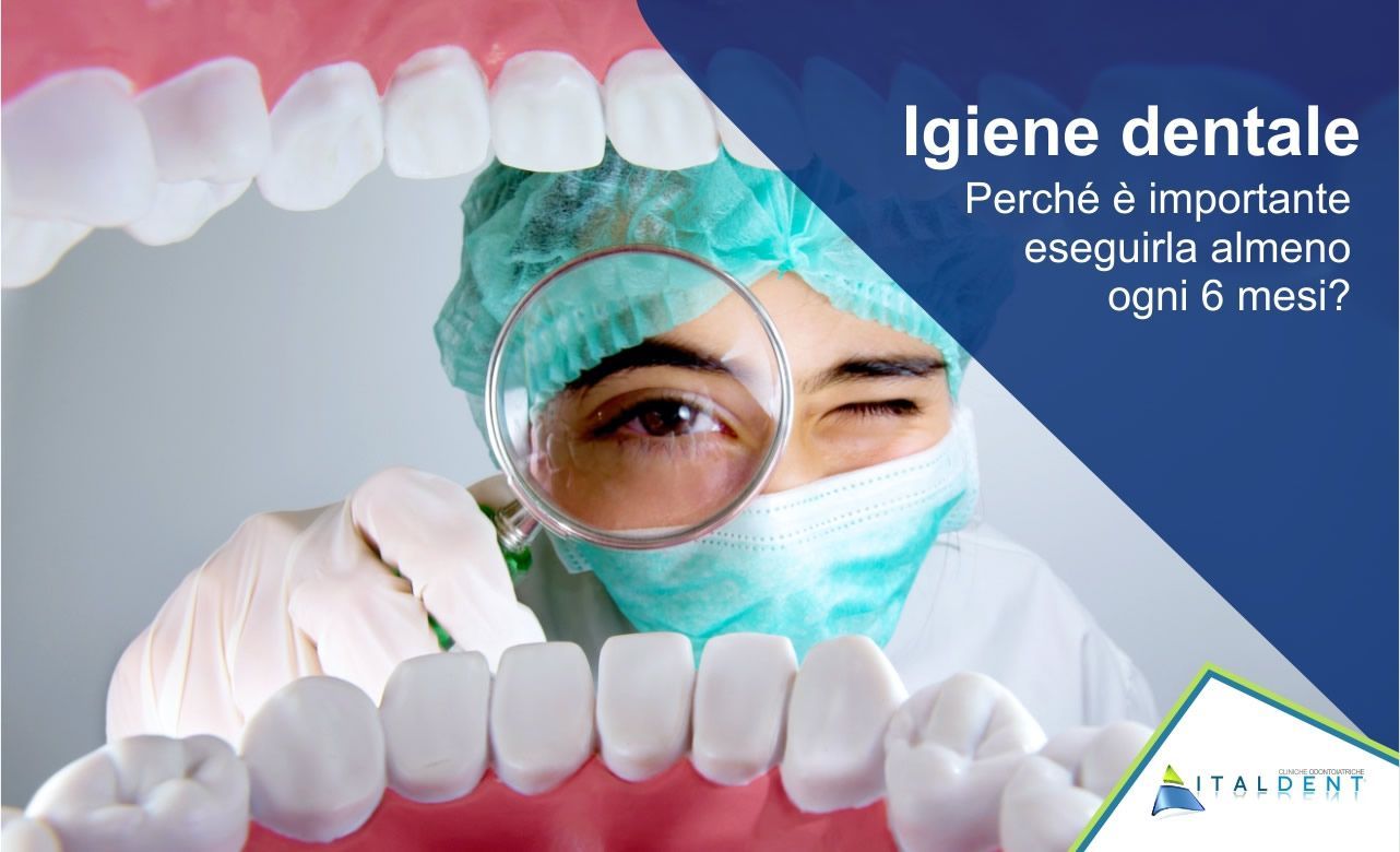 Perché è così importante eseguire ogni 6 mesi l'igiene orale?