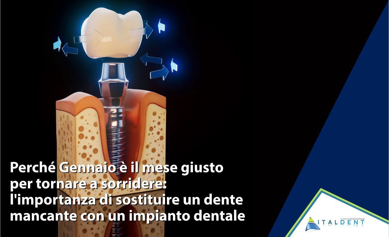 Perch� Gennaio è il mese giusto per tornare a sorridere: l'importanza di sostituire un dente mancante con un impianto dentale