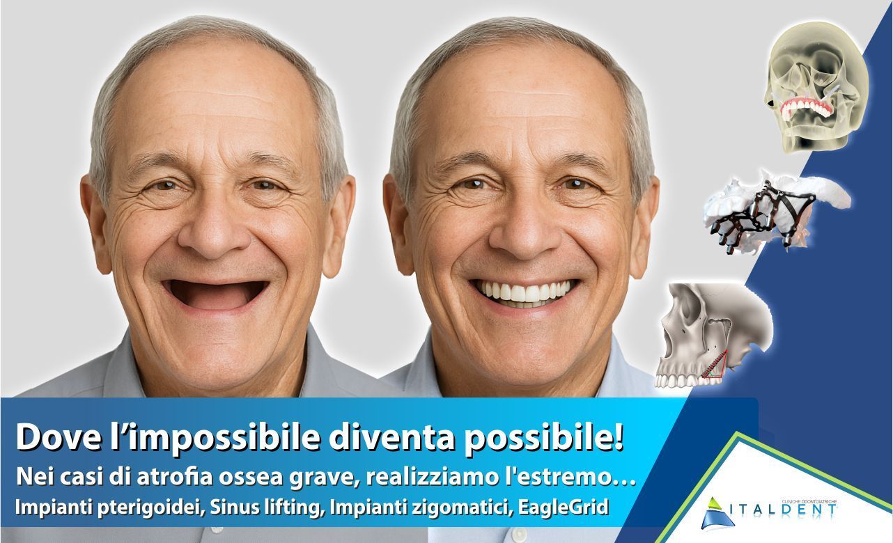 Dove l'impossibile diventa possibile - Implantologia dentale avanzata a Palermo