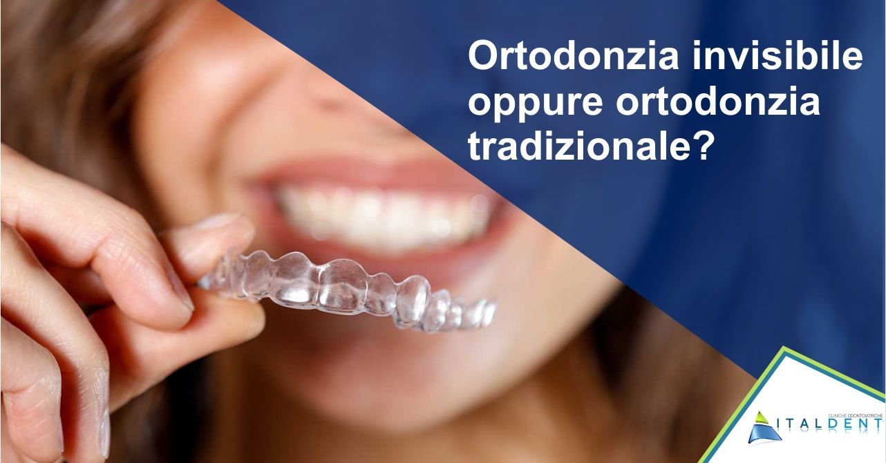 Ortodonzia invisibile oppure ortodonzia tradizionale? Noi ti presentiamo Nuvola