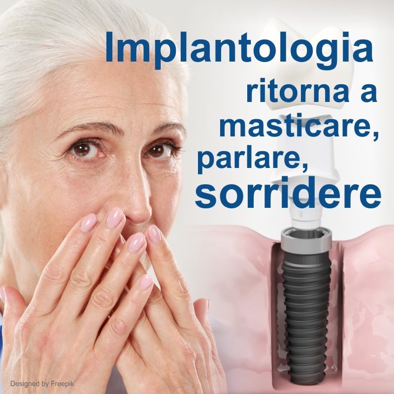 Torna a sorridere, masticare e parlare con l'implantologia a Palermo