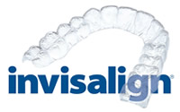 Invisalign l'ortodonzia invisibile