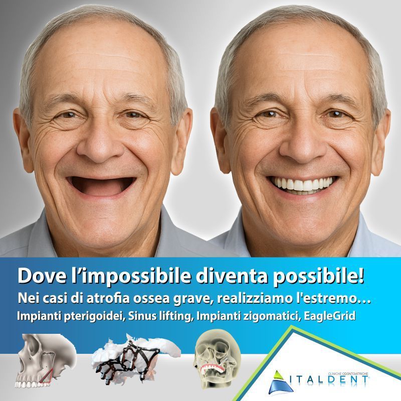 Dove l'impossibile diventa possibile - Implantologia dentale avanzata a Palermo