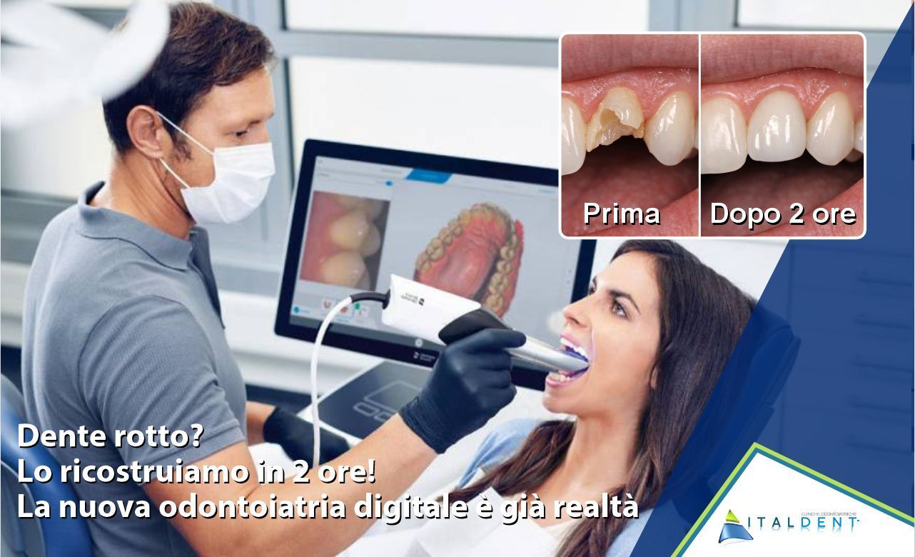 Dente rotto? A Palermo lo ricostruiamo in 2 ore: la nuova odontoiatria digitale è già realtà