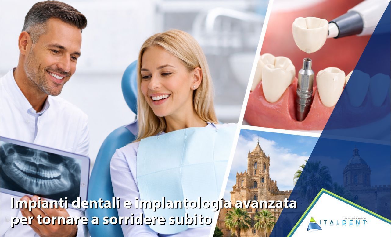Dentista a Palermo: impianti dentali e implantologia avanzata per tornare a sorridere subito
