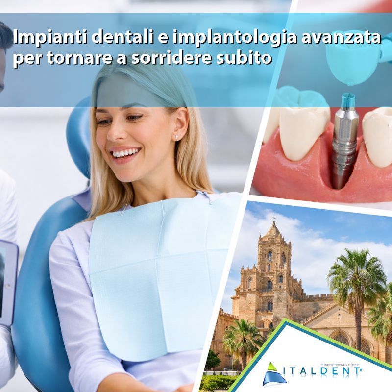 Dentista a Palermo: impianti dentali e implantologia avanzata per tornare a sorridere subito