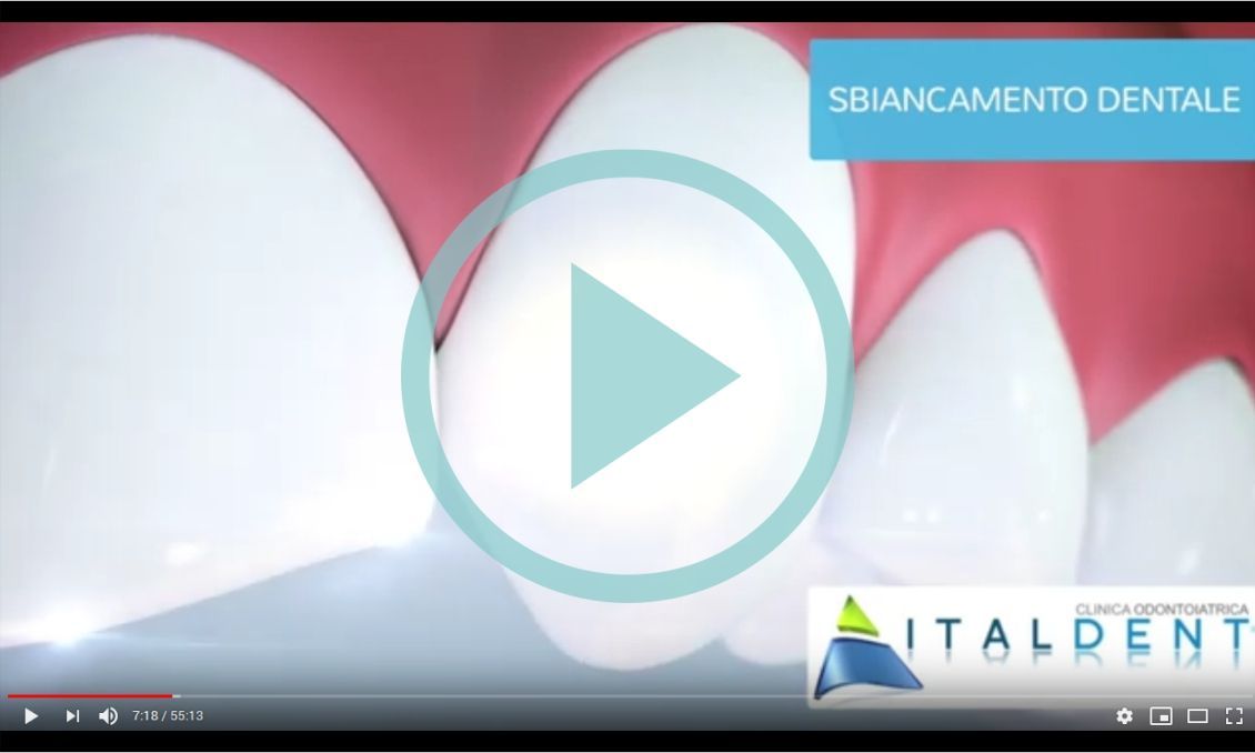 Trattamenti clinica odontoiatrica Italdent